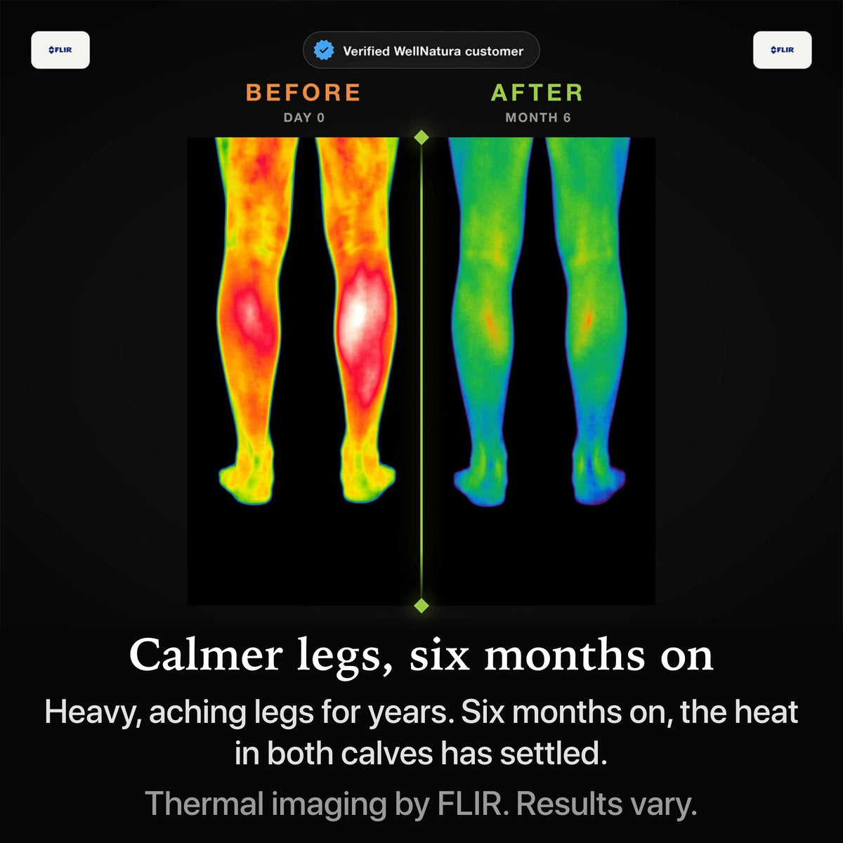 Thermal imaging of calmer legs after six months on the WellNatura topper