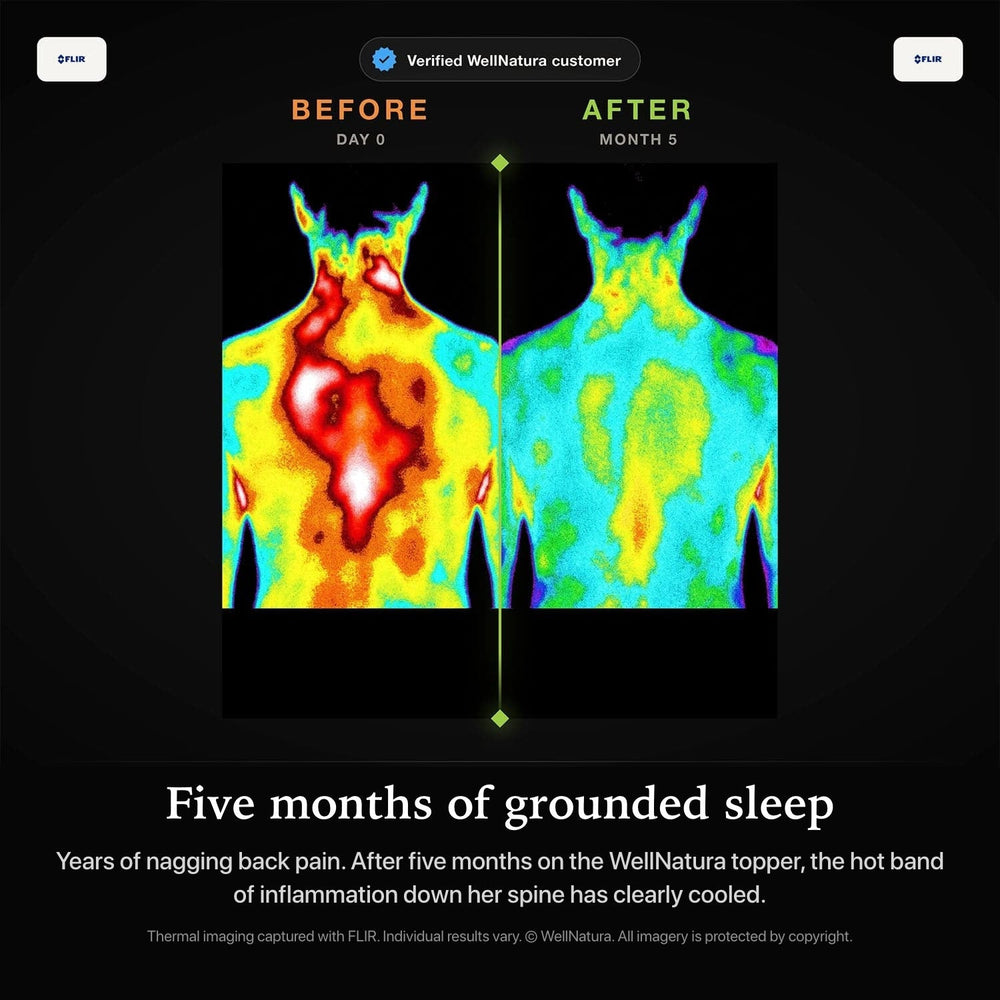 Thermal scan of the upper back, before and after grounded sleep
