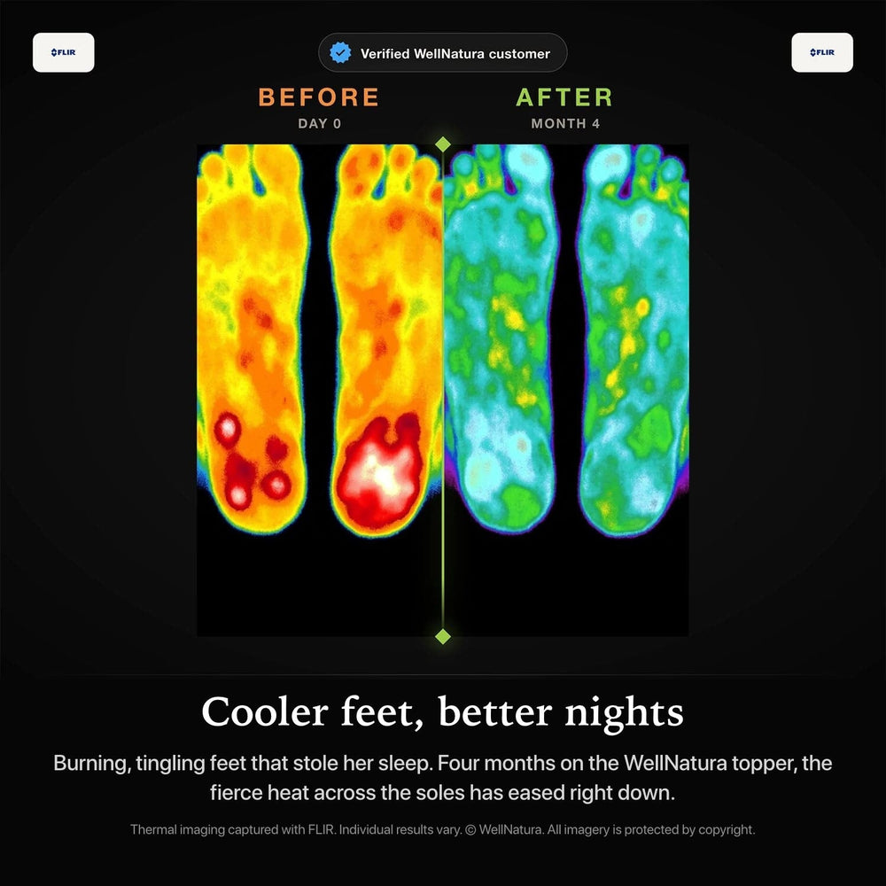 Thermal scan of the soles of the feet, before and after grounded sleep