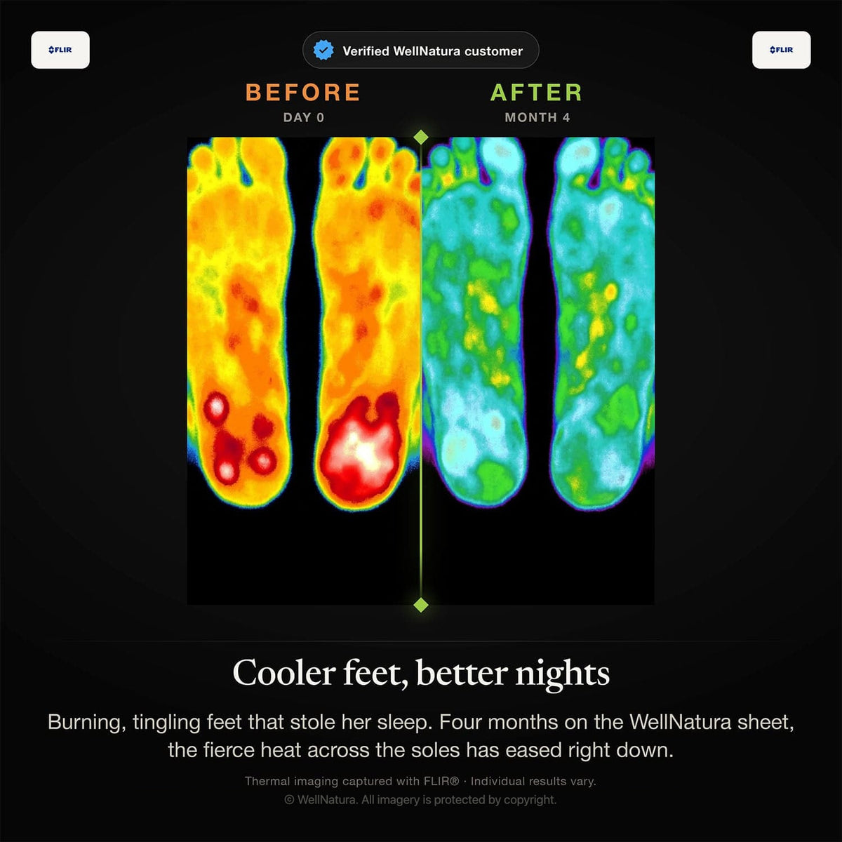 Thermal images before and after four months on the WellNatura grounding sheet: feet