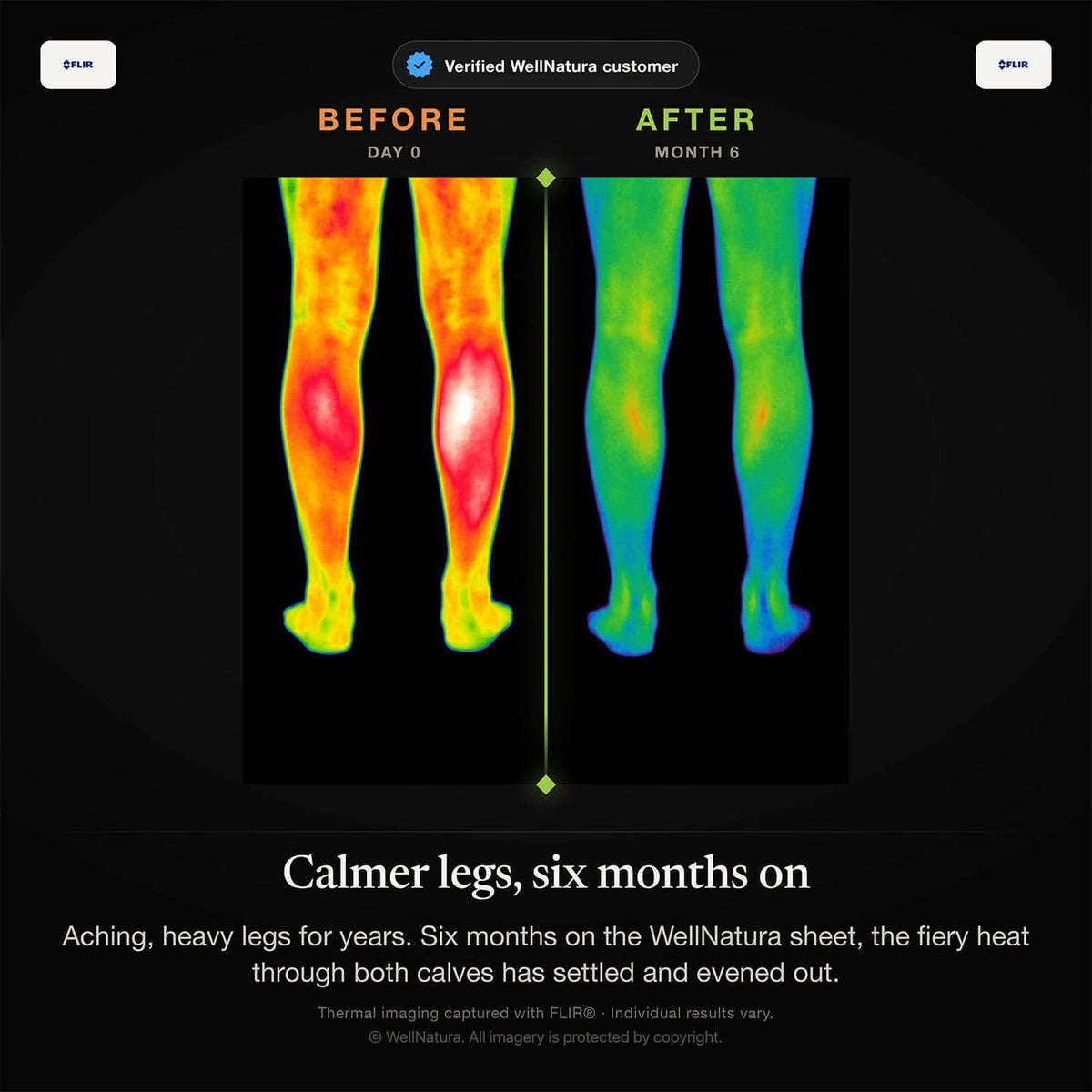 Thermal images before and after six months on the WellNatura grounding sheet: legs