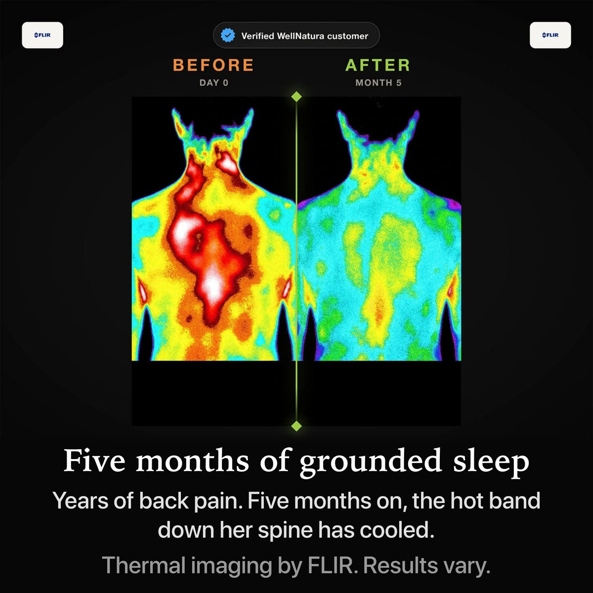 Thermal imaging before and after five months of grounded sleep on the WellNatura topper